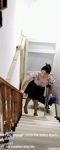 Shortleg polio girl climbing stairs.