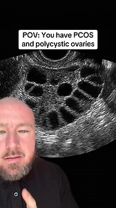 743K views · 2.8K reactions | Polycystic ovaries and PCOS are NOT the...