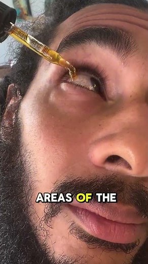 Why use Jimerito Honey eye drops? Removes floaters Alleviates Dry Eye Reverses astigmatism