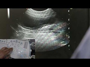 Optimising your ultrasound image