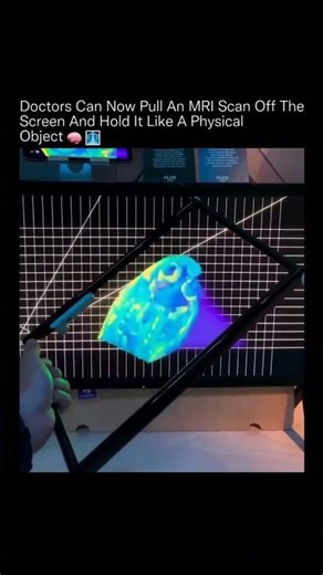 Doctors can now view and interact with MRI in 3d! #medicaltechnology #technology #hologram