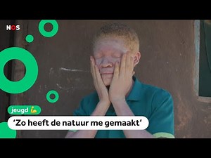 Zorgen in Malawi; mensen met albinisme worden bedreigd