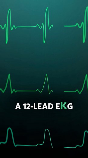 Setting up a 12-lead ECG. #ekg #paramedicschool #ems | The Paramedic Coach