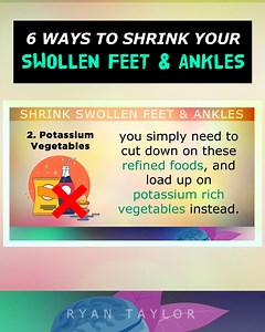 6 Ways To SHRINK Your SWOLLEN FEET & ANKLES #nutrition #ryantaylornaturalremedies #swollenfeet #SwollenAnkles #swollenlegs | Ryan Taylor Natural Remedies