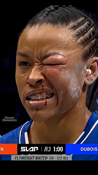 BRUTAL Slap Fight Aftermath #slapfight #knockout #viral