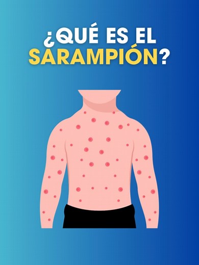 ¿Qué es el sarampión o rubeola? Enfermedades y síntomas