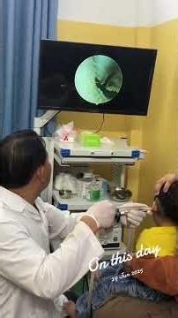 Deep Ear Cleaning Transformation 👂 | Huge Wax Plug Gone Instantly #entclinic #health #viral