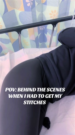 Behind the Scenes of My Stitches Experience