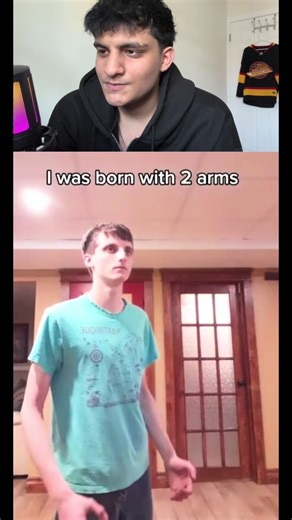 Born with One Arm: A Unique Perspective