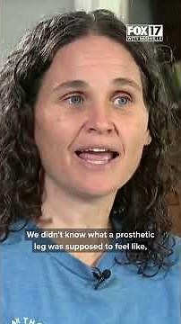 Alex Morgan lost her leg five years ago to a rare bone disease.