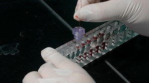 Author Spotlight: Advantages of Pressure-Volume Loop Measurement Method in Cardiovascular Research