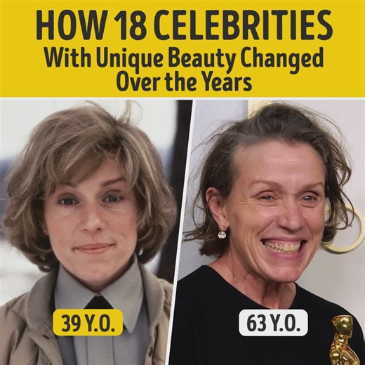 How 18 Celebrities With Unique Beauty Changed Over the Years | You're Gorgeous