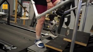 1.5K views · 29 reactions | A new prosthesis, driven by the nervous...