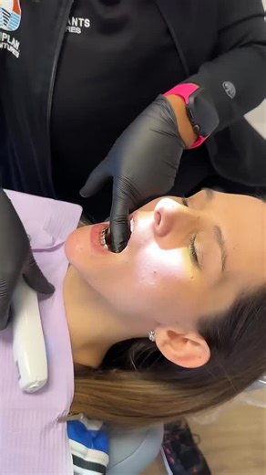 Gold Teeth: The Trend in Modern Dentition