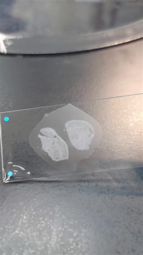 43K views · 559 reactions | Histopathology ❤️❤️ #lablife #histopathology #diagnosis | Lab life | Facebook