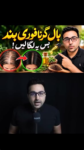 Stop Hair Fall Naturally: Easy Hair Care Secret for Stronger Hair