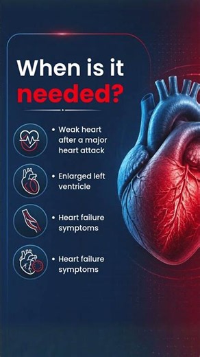 Explained LV Reconstruction #heartsurgery #cardiaccare