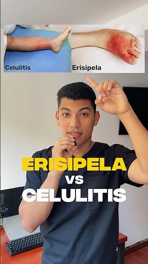 Erisipela vs Celulitis 📚 Diferéncialas con facilidad 🚨