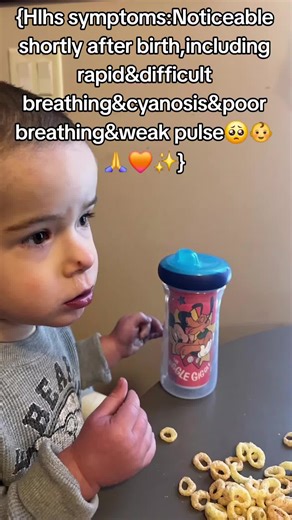 {Hlhs information that you should know if your child has it like ours does🥺👶🙏🧡✨️} . . . . . #hlhswarrior #chdawareness #factsonhlhs #heartwarrior