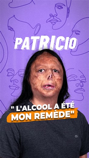 REDIFF | “C’est vite devenu un remède à la solitude ou à la tristesse” A presque 40 ans, ce grand brûlé, veut alerter sur les dangers de l’alcool, en particulier pour les personnes porteuses d’un handicap. Lui-même a sombré dans l’alcoolisme pendant son adolescence. Aujourd'hui, il soigne sa dépendance et il a à cœur de partager son histoire. | Vews - RTBF