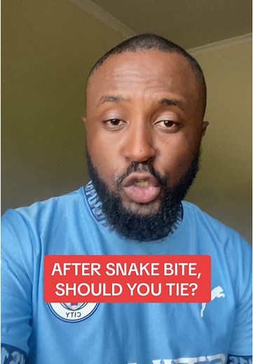 AFTER SNAKE BITE, SHOULD YOU TIE ABOVE THE BITE? #snakebite #firstaid #snakebitetreatment #healtheducation #viralvideo🔥