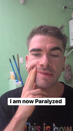 I am now Paralyzed, & how it happened… | Joel Hansen - Model Vs Food