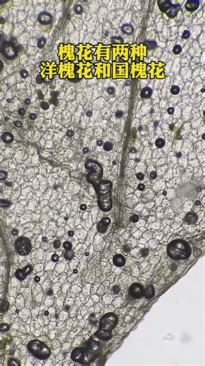 Acacia Flowers Under the Microscope!