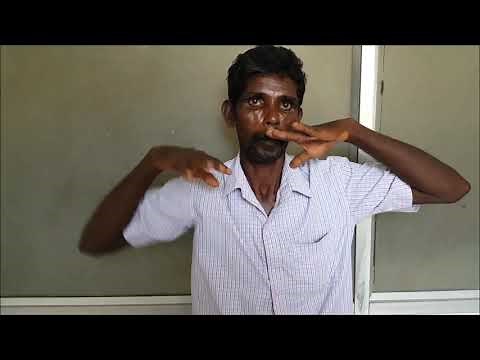 WING BEATING TREMORS, KF RING Wilson’s disease