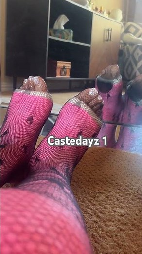 Double long leg cast #legcast #broken #legs #stockings #cast