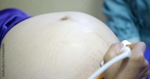 Gynecologist checking female patient's fetal life signs with ultrasound scanner.