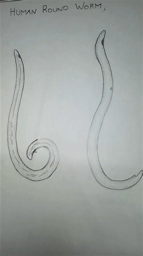 Figure 3 Human Round Worm -Zoology #drawing #zoologyrecord #art #voidartsss