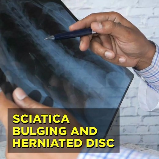 Bulging Disc, Herniated Disc, Degenerative Disc, Spinal Stenosis, Sciatica, Leg Pain… At Disc Centers of America - Queens, we specialize in treating chronic back, neck, and sciatica pain using our 𝗕𝗿𝗲𝗮𝗸𝘁𝗵𝗿𝗼𝘂𝗴𝗵 𝗙𝗗𝗔-𝗖𝗹𝗲𝗮𝗿𝗲𝗱 𝗡𝗼𝗻-𝗦𝘂𝗿𝗴𝗶𝗰𝗮𝗹 𝗦𝗽𝗶𝗻𝗮𝗹 𝗗𝗲𝗰𝗼𝗺𝗽𝗿𝗲𝘀𝘀𝗶𝗼𝗻 𝗧𝗿𝗲𝗮𝘁𝗺𝗲𝗻𝘁 𝗣𝗿𝗼𝗴𝗿𝗮𝗺. We know those suffering with chronic back pain have often tried several treatments with disappointing results and simply want a solution that provides LONG-T