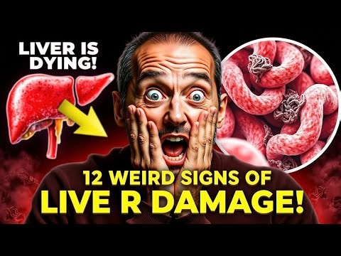 LIVER is DYING! 12 Weird Signs of LIVER DAMAGE! (Doctor Explains!) Fatigued melting!