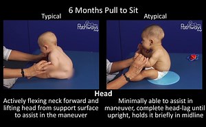 13 reactions · 14 shares | What does a 6-month-old baby's motor...