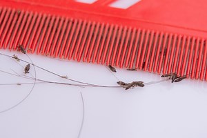 Where Do Lice Come From? Identification, Symptoms of Infestations & Prevention - Today's Homeowner