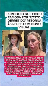 ÍCONE DE REALITY SHOW SURGE COM NOVO VISUAL APÓS CHOCAR FÃS COM FOTO RECENTE..