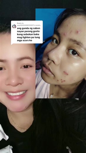 Effective Scar Removal Solutions: A Guide