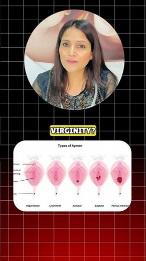 Torn Hymen🩸 == Loss of Virginity 🫡