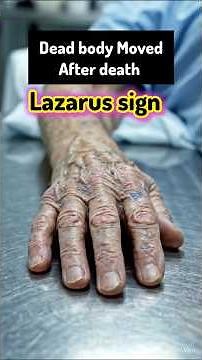 “Lazarus Sign: Science Behind the Sudden Movements”#BrainDeath #‪@SmartMedicalKnowledge‬