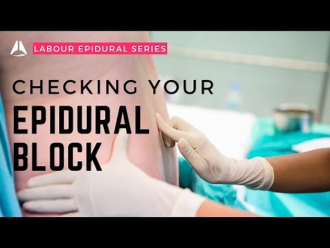 Checking your epidural sensory level and motor block | #anesthesiology #anesthesia #epidural