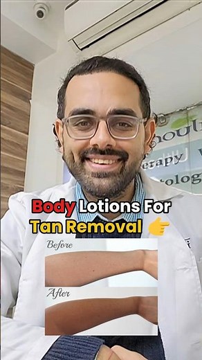 Best Lotions For Tan Removal 👉 #TanRemoval #BodyLotion #SunTanRemoval