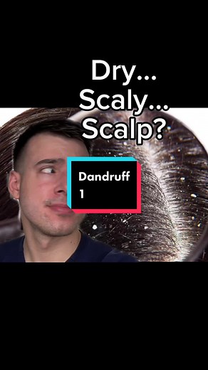 Understanding Dandruff Causes and Solutions Explained