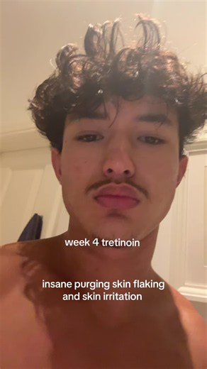 Tretinoin Week 4: Purging, Flaking & Irritation Care