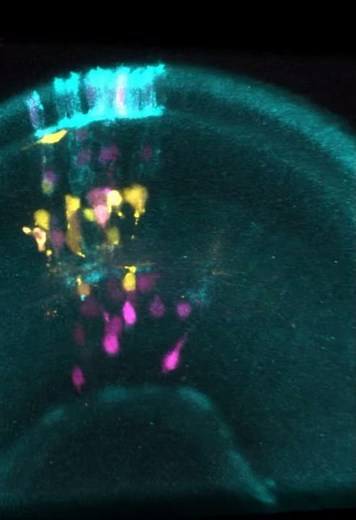 Retina of a zebrafish