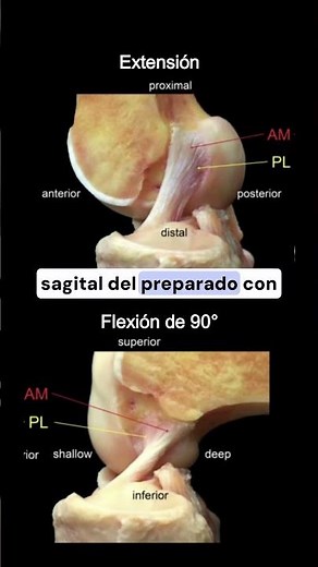 Ligamento cruzado anterior: ¿Qué es?