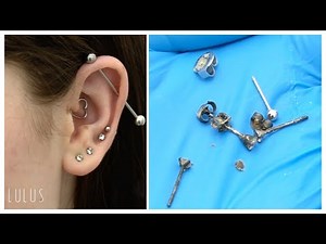 Removing Gunky Tarnished Jewelry From Her Ear!! | S4 EP:23