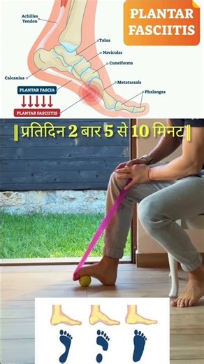 Plantar fascitis & Hallux valgus pain relief exercises #painrelief #exercise #shorts #viral #youtube