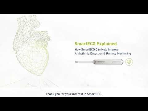 SmartECG Explained: How SmartECG Can Help Improve Arrhythmia Detection