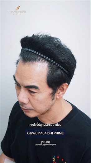 จากปัญหาเดิม สู่เวอร์ชั่นที่ดีกว่าด้วยเทคนิค DHI PRIME