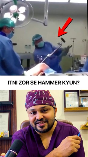 😳Why Orthopedic Surgeons Use hard Hammer?🔨